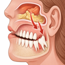 Featured image for How Wisdom Teeth Can Cause Sinus Problems