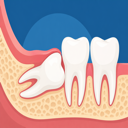 Featured image for Sideways Wisdom Teeth? What Patients Should Expect
