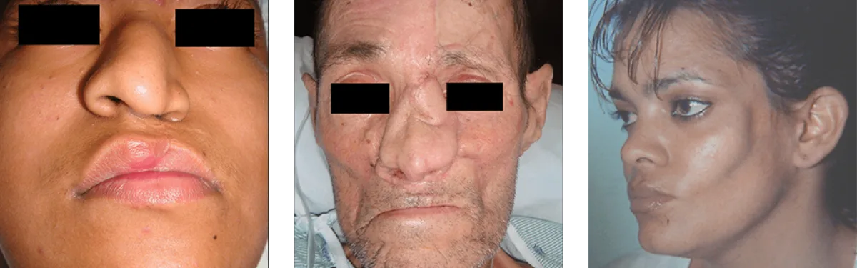Detailed clinical imaging of maxillofacial reconstructive tissue flaps and anatomical restoration